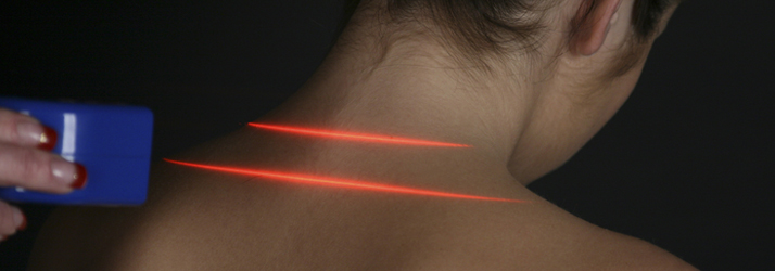 Chiropractic Culver City CA Cold Laser Therapy