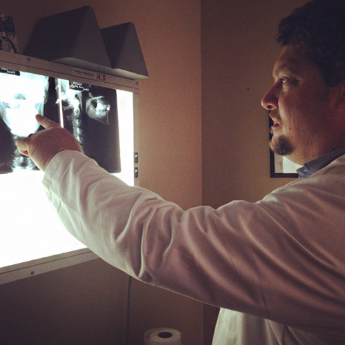 Chiropractor Culver City CA Michael Zalben Benefits Of Chiropractic X-Rays